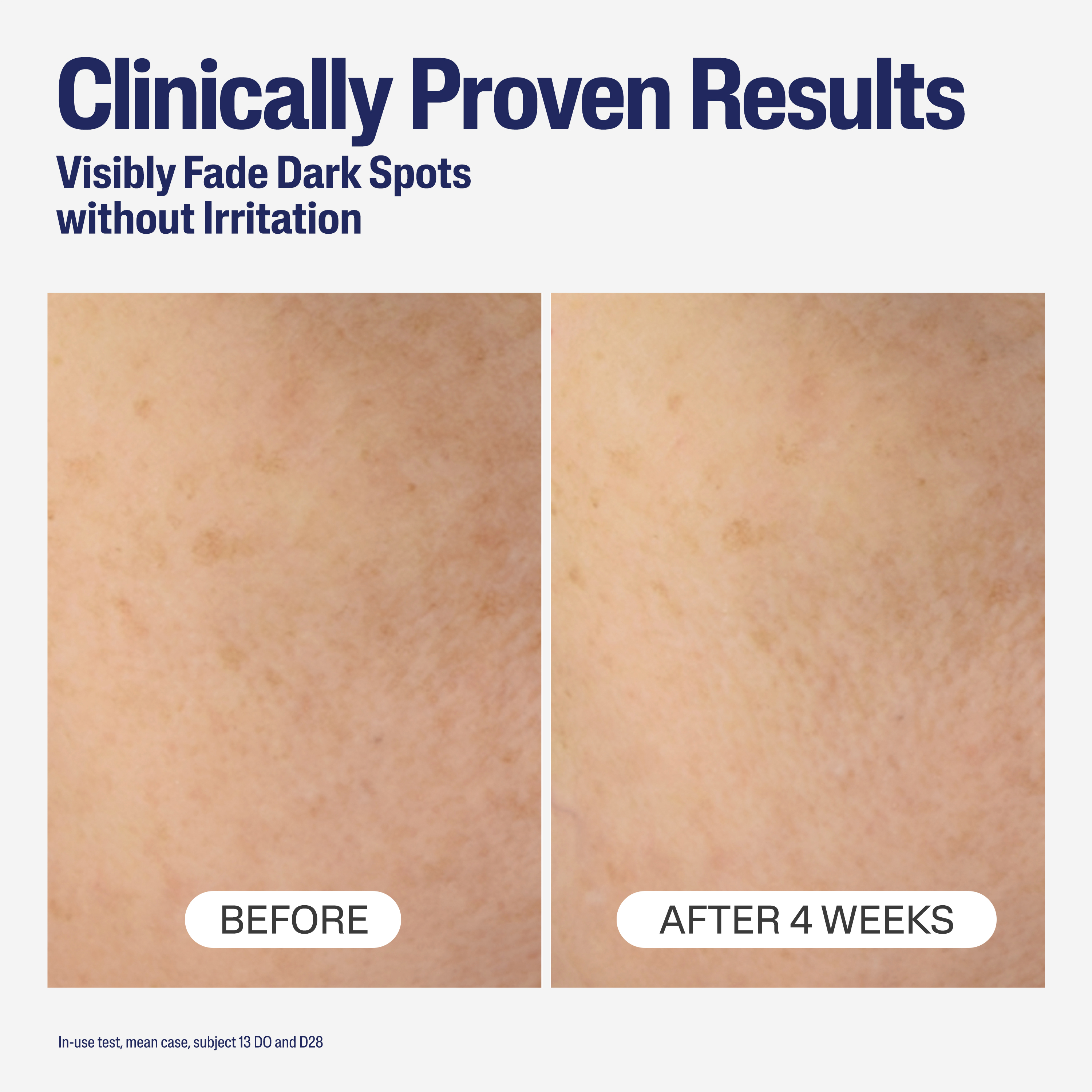 Bright Healthy Radiance Brightening Night Comfort Cream