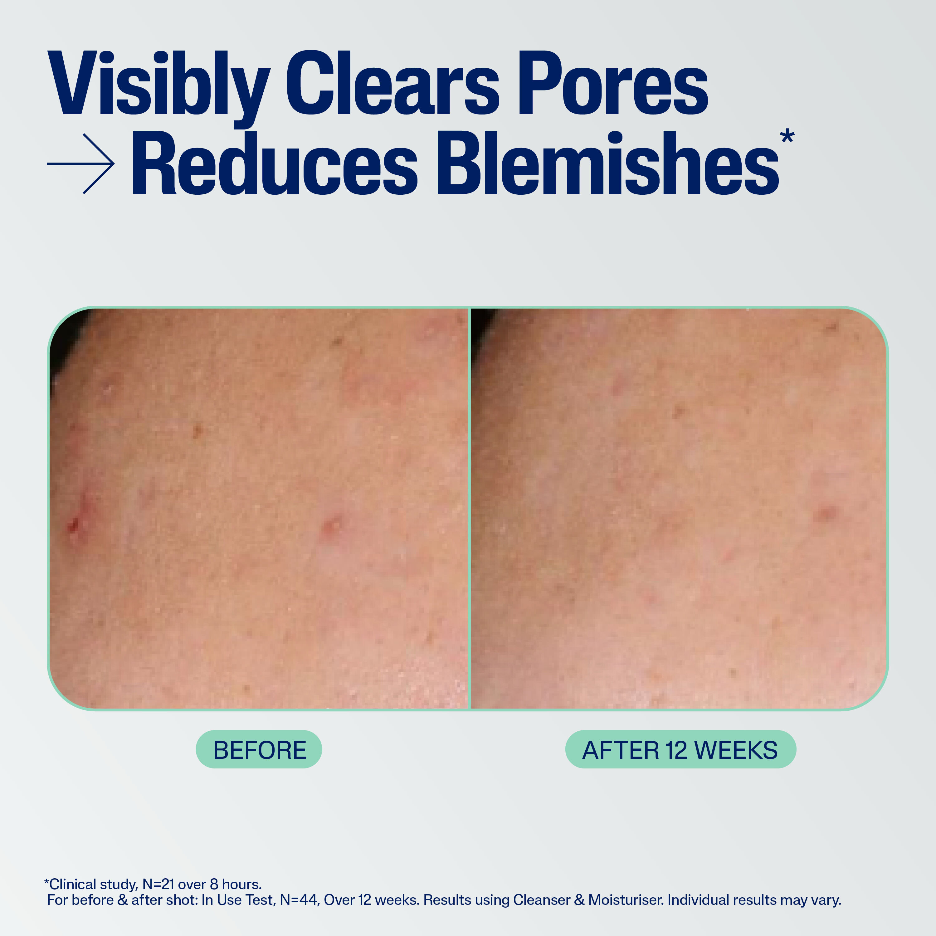 Blemish Cleanser