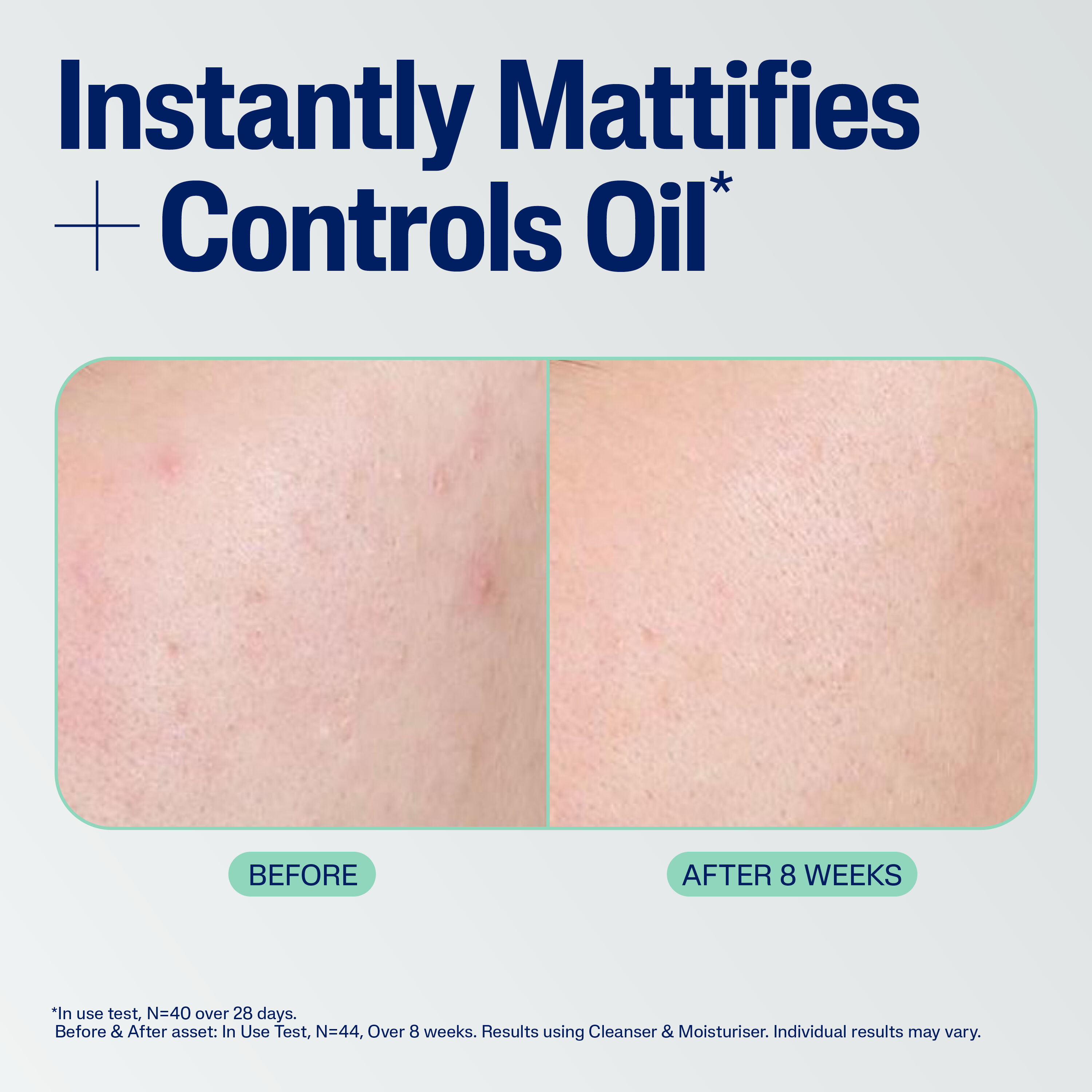 Mattifying Blemish Moisturiser