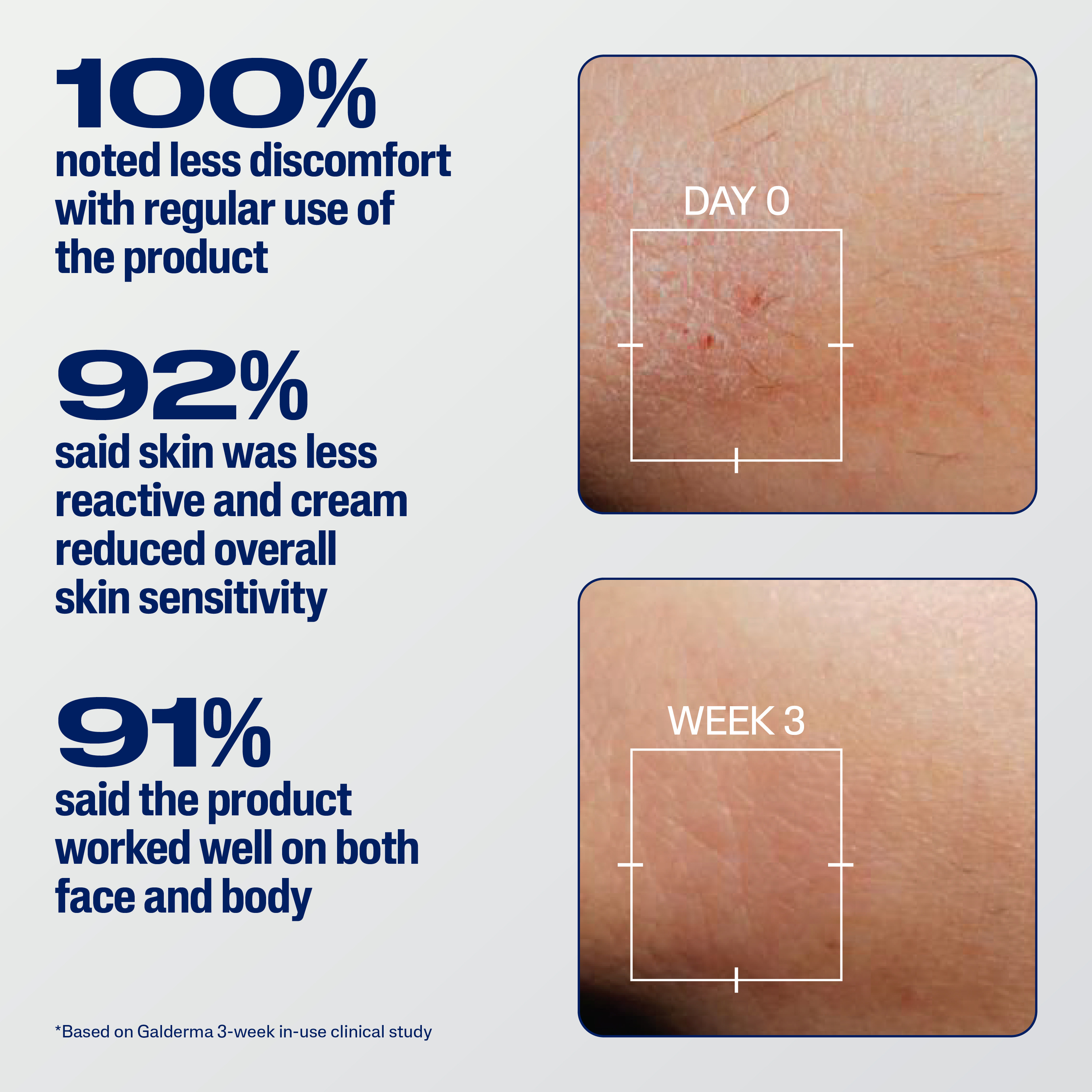 PRO Eczema Soothe & Repair Cream